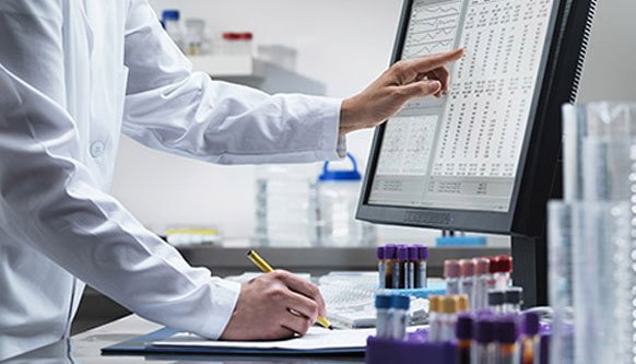 De-Oiled Rice bran (DORB) testing